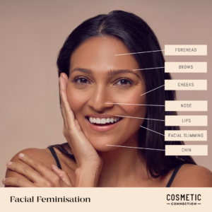 A person smiling, touching their face, with labels pointing to different facial areas: forehead, brows, cheeks, nose, lips, facial slimming, and chin. Text reads Facial Feminisation and Cosmetic Connection.