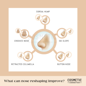An infographic illustrating different types of noses that can be reshaped using non-surgical rhinoplasty and nose filler: dorsal hump, crooked nose, ski slope, retracted columella, and button nose. Each type is connected to a central image of a stylized nose.