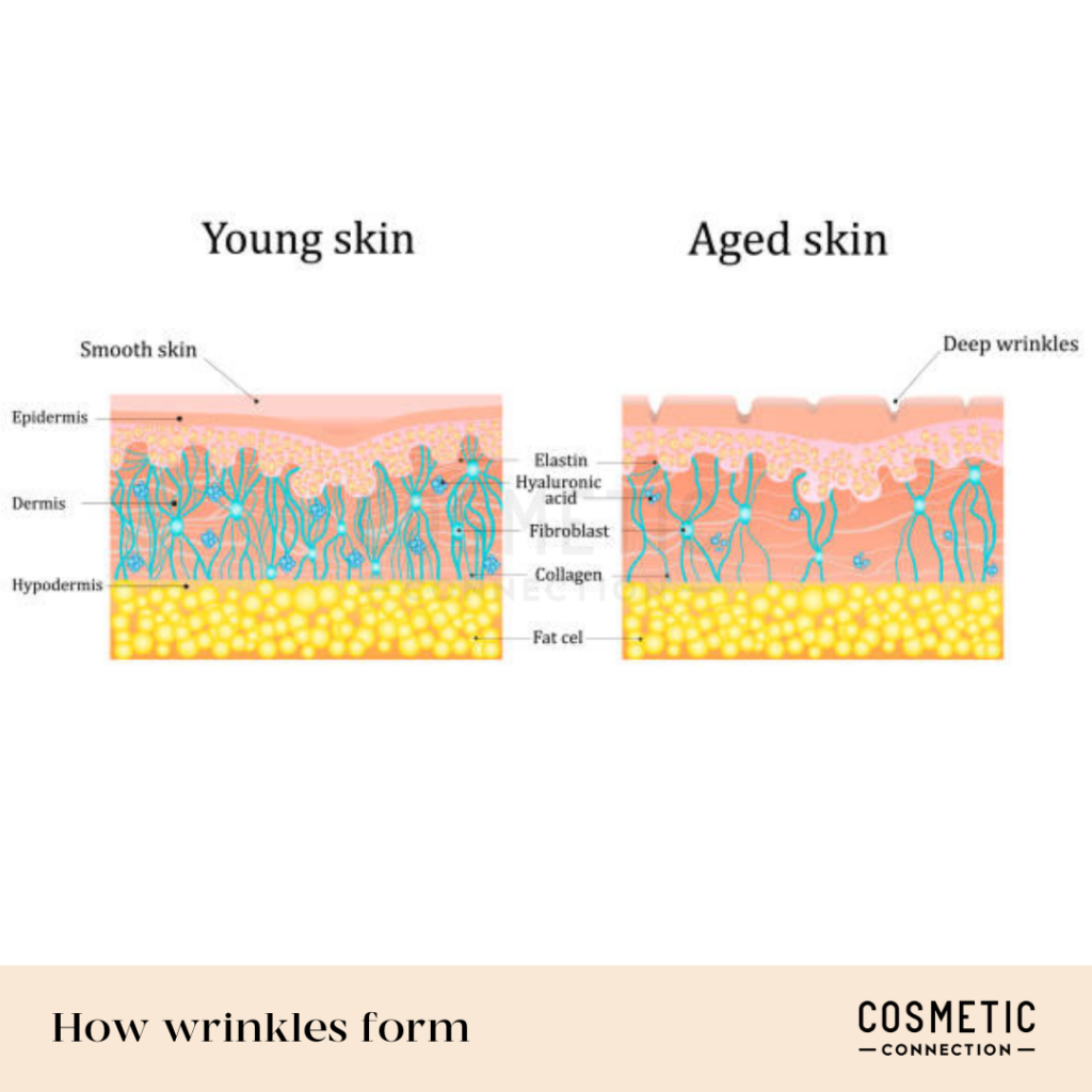 Accordion Line Filler Non Surgical Treatments