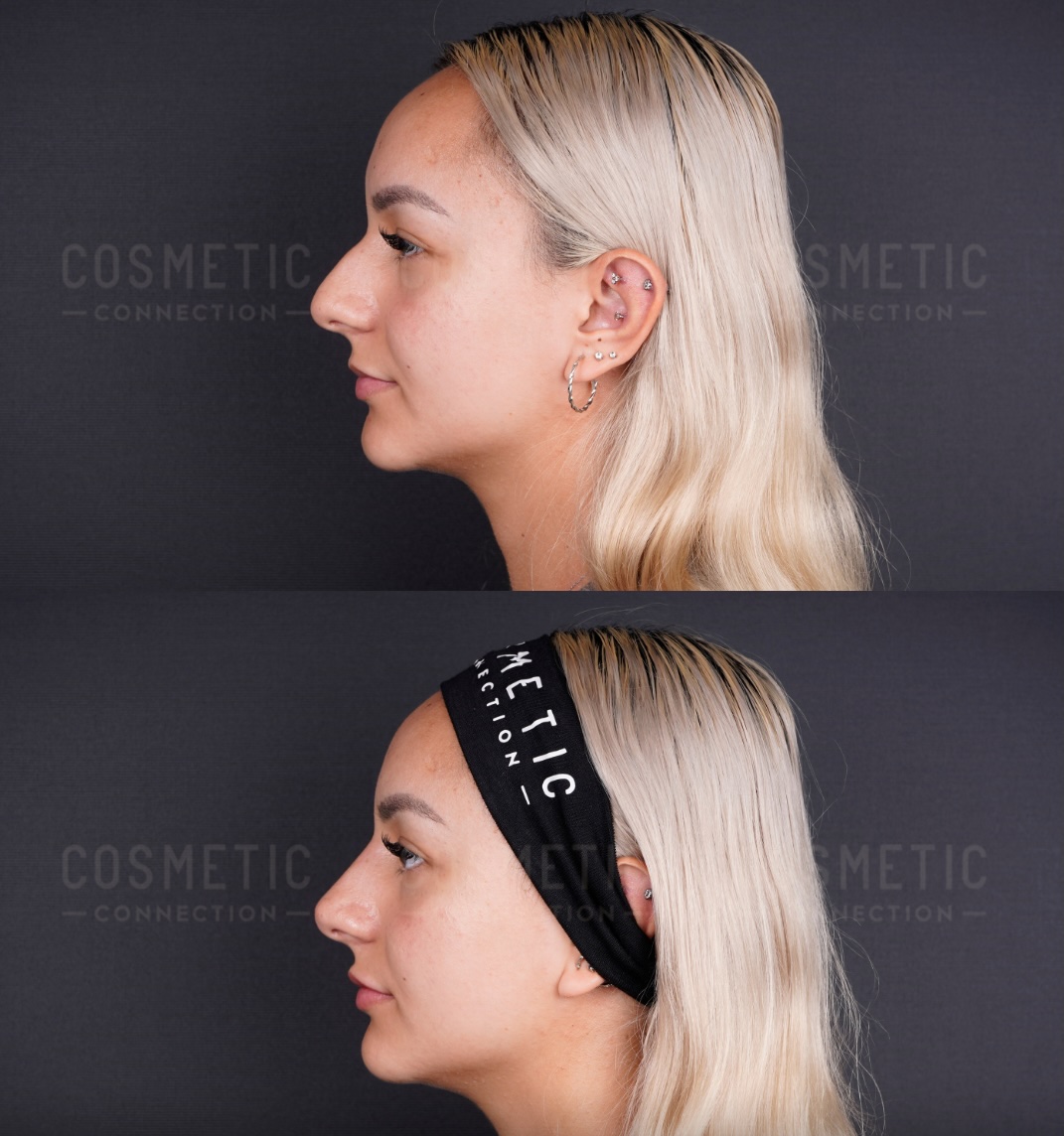 Two side profile images of a person with long blonde hair are shown. The top image has the hair tucked behind their ear. The bottom image shows the hair held back with a black headband. The background is gray with Cosmetic Connection text.