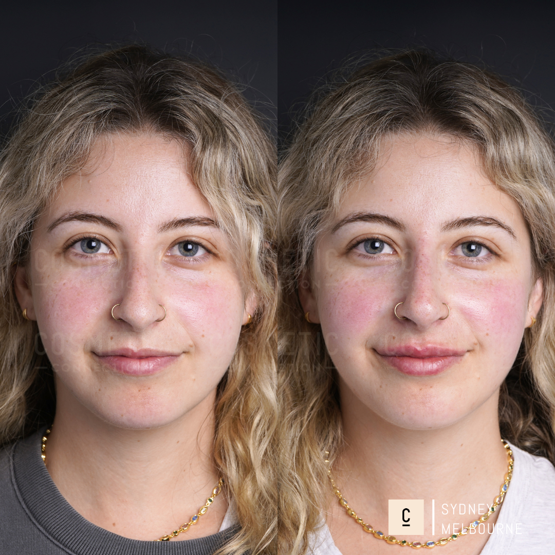 Side-by-side images of a woman with wavy blonde hair. Left: She wears a gray shirt. Right: She wears a gray top and has a subtle smile. The background is dark, and both images have similar lighting. There is text in the corners.