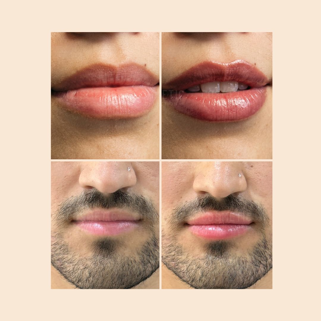 A four-panel image showing two sets of lips, before and after makeup. The top row features fuller, glossy lips on a woman. The bottom row highlights lip enhancement on a man’s lips, which appear shinier and more defined in the after image.
