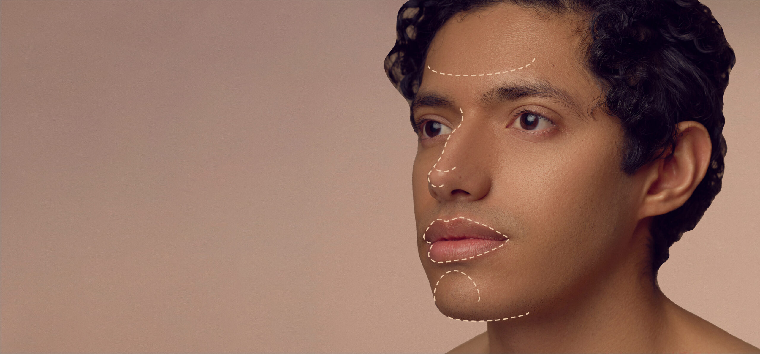 A close-up of a person with curly hair, featuring dotted lines on their face indicating possible areas for cosmetic enhancement on the forehead, nose, chin, and lips. The background is a neutral tone.