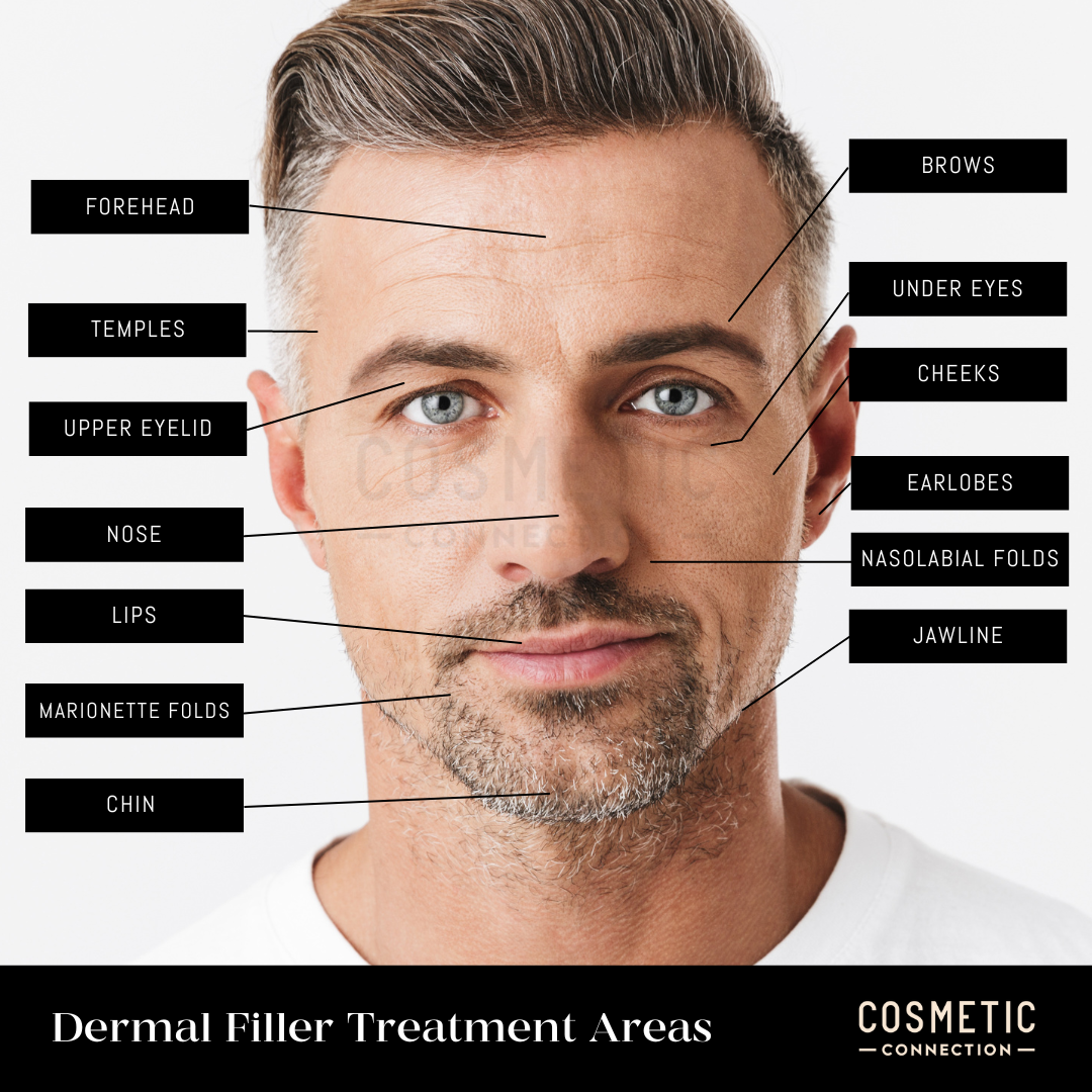 Fillers For Face Near Me