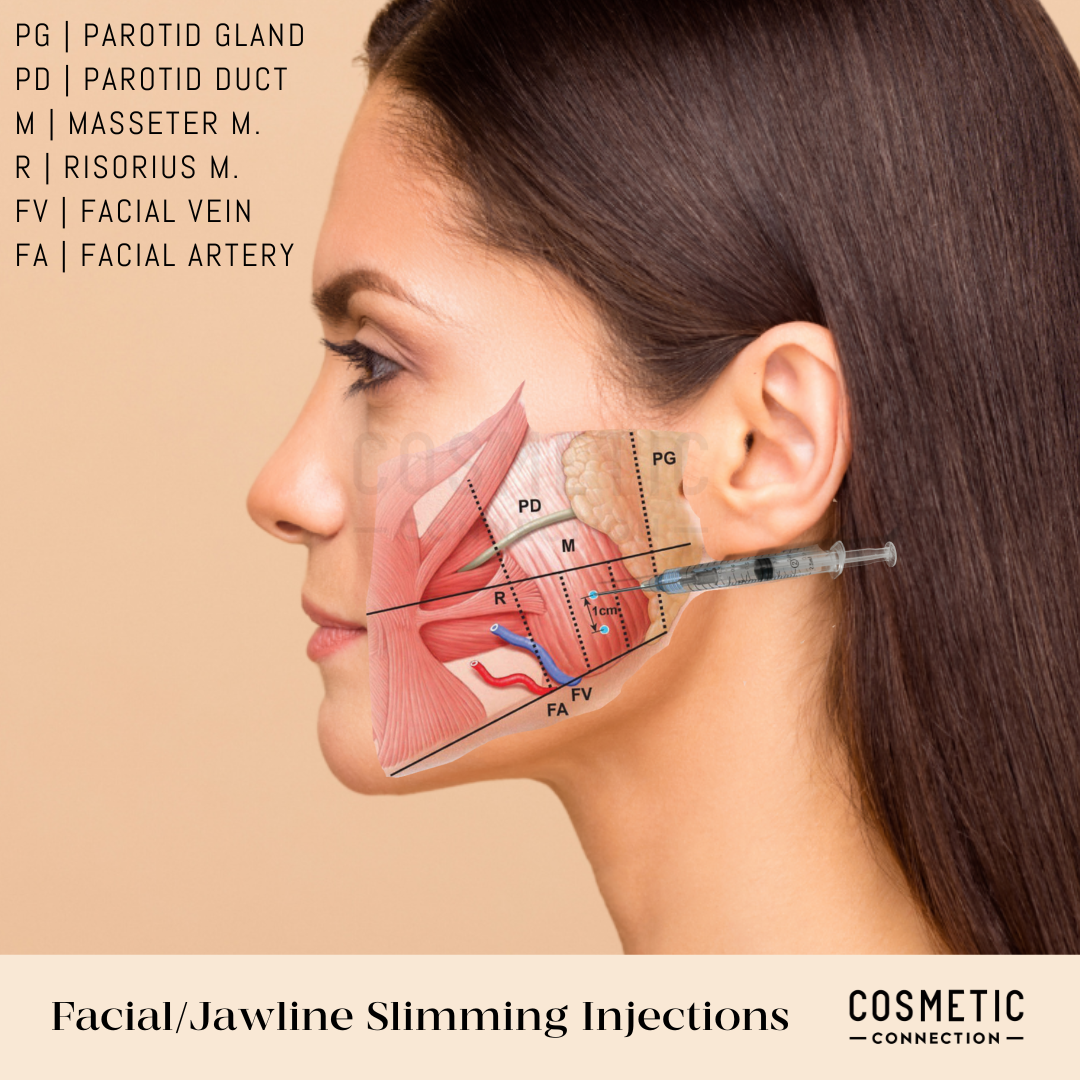V-Shape Botox Injection (Enhance Facial Contour With Slimmer Jawline)