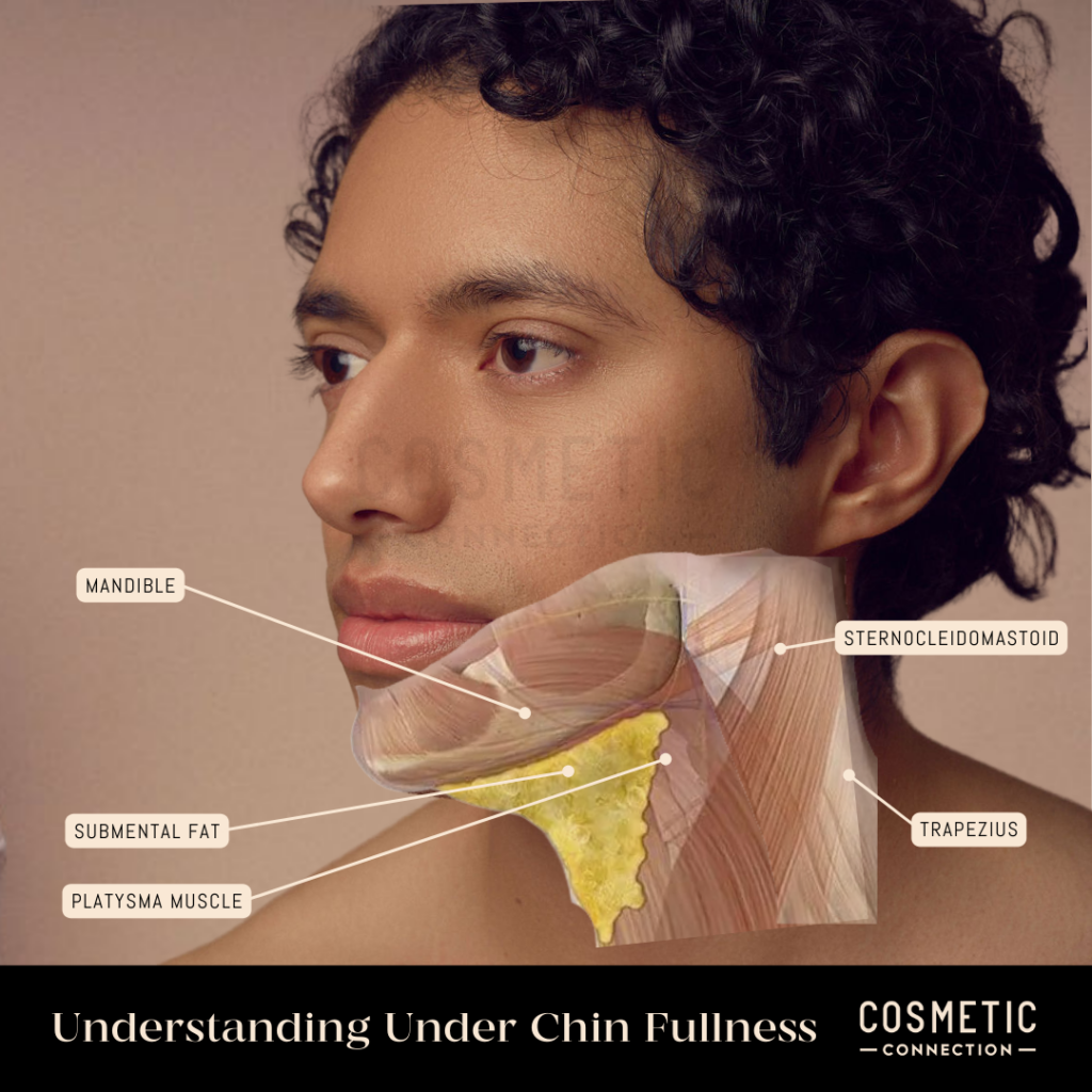 How To Get Rid Of A Double Chin Cosmetic Connection how-to-get-rid-of-a-double-chin-cosmetic-connection