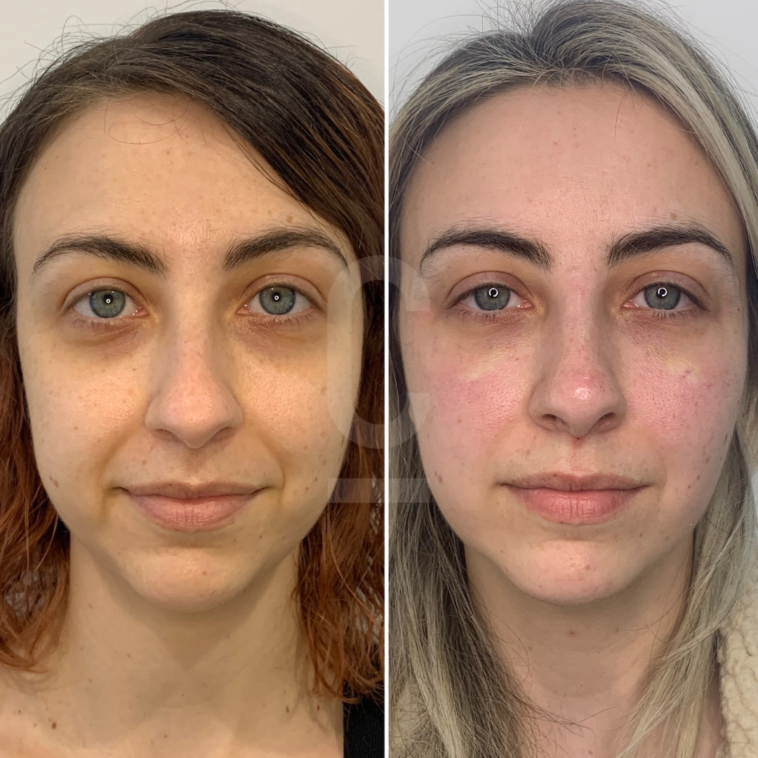 Side-by-side comparison of a woman with brown hair on the left and blonde hair on the right, showing changes in hair color and facial appearance. The left image shows a more tanned complexion, while the right image has a lighter skin tone.