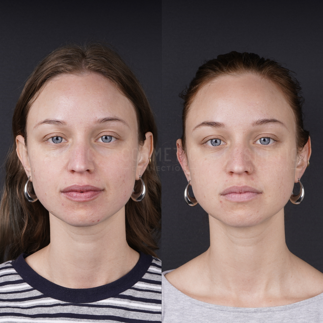 Side-by-side photos of a woman with light skin, blue eyes, and light brown hair, wearing hoop earrings; the left image shows her with her hair down, the right with her hair pulled back, both against a dark background.