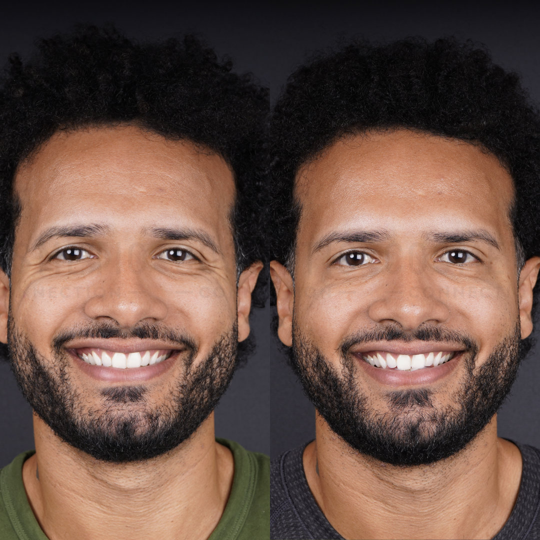 Smiling man with curly hair and a beard shown in two side-by-side images. The left image has subtle differences in facial expression and clothing compared to the right. Both images have a dark background.