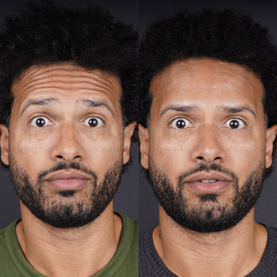 Two side-by-side portraits of the same bearded man with wide eyes and a surprised expression. The left image shows him wearing a green shirt, while the right shows him in a gray shirt. The background is plain black.