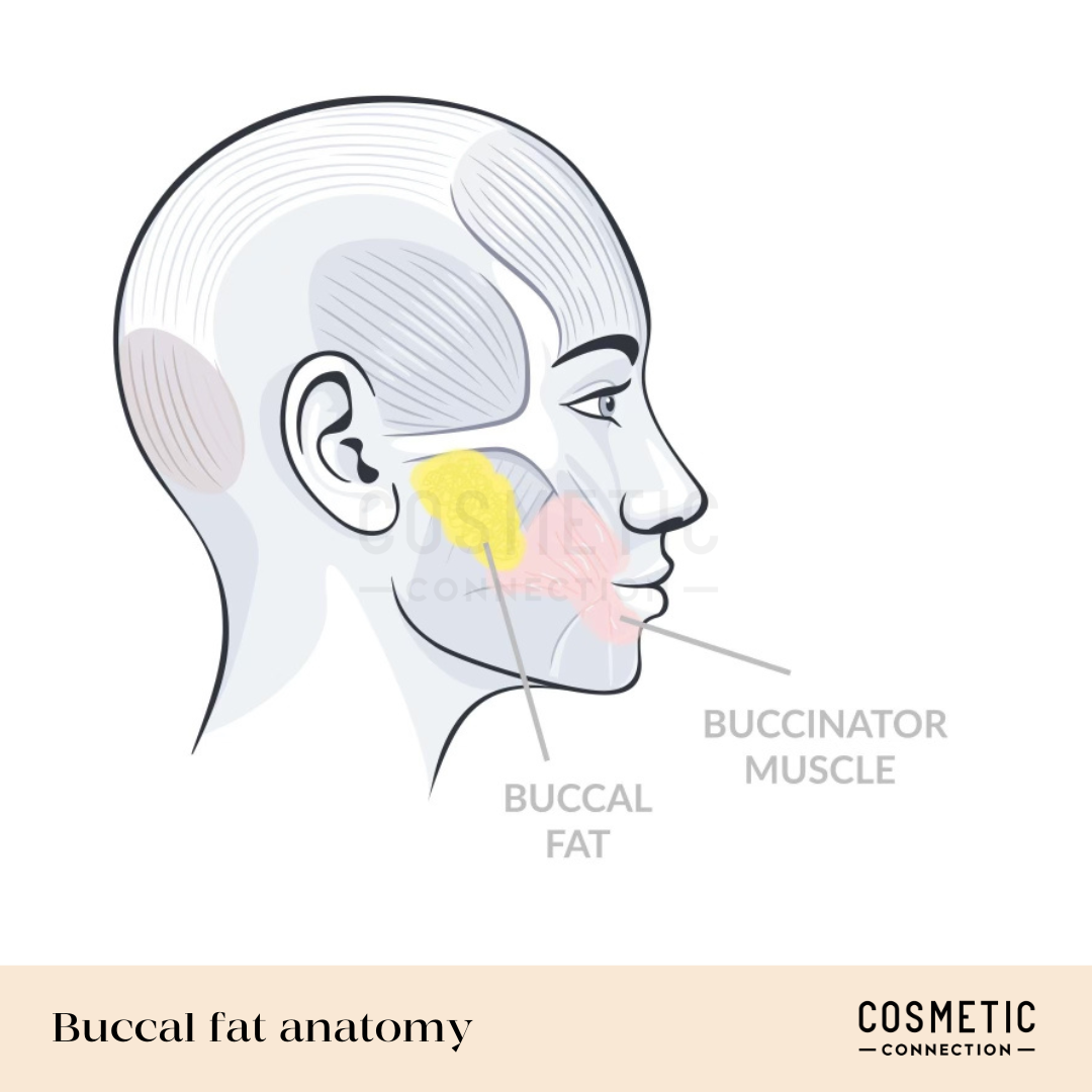 The most important things to know about buccal fat removal