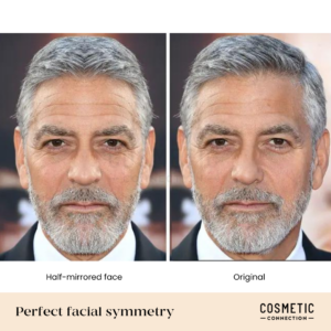 Side-by-side comparison of a mans face with a half-mirrored version on the left and the original on the right. Both have gray hair and beards. The image is labeled Perfect facial symmetry with Cosmetic Connection at the bottom.