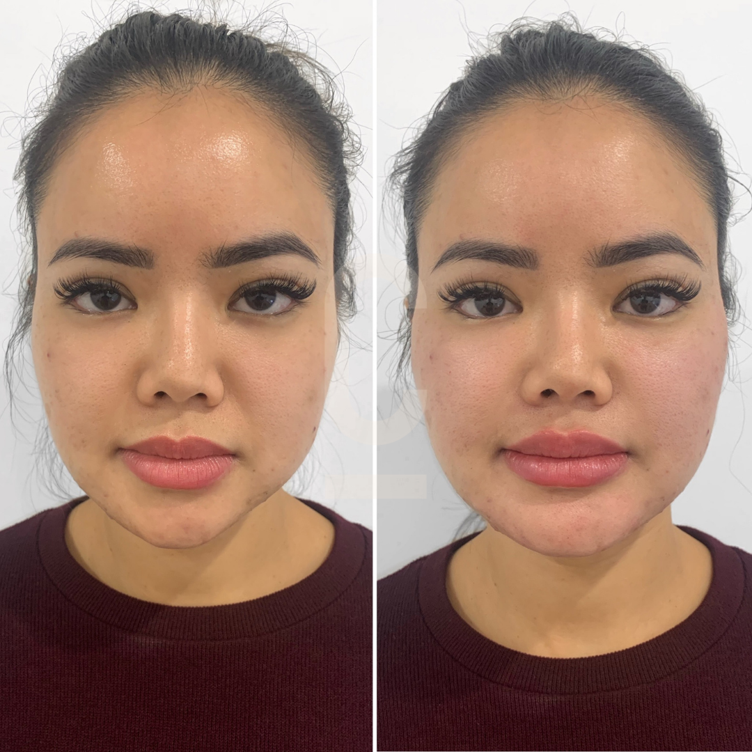 Side-by-side images of a woman facing forward. The left image shows her with natural makeup, slightly matte skin, and defined eyebrows. The right image has her with glossed lips, a dewy complexion, and similar eyebrow makeup.