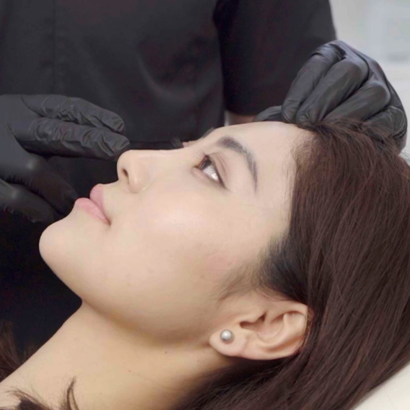 Achieving a Defined Jawline - Cosmetic Connection