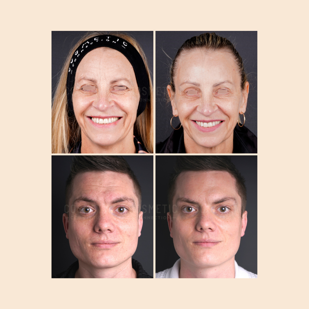 A collage of four portraits against a neutral background. The top row shows an older woman smiling and then with a neutral expression. The bottom row shows a younger individual with short hair, first with a neutral face and then slightly more serious.