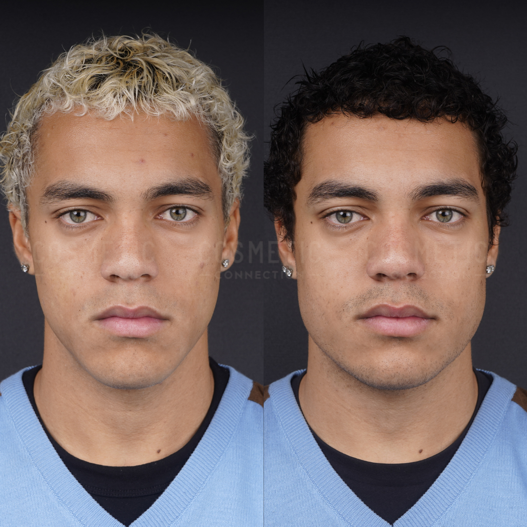 Side-by-side portraits of the same man; left shows short, bleached blond curly hair, right shows short, dark curly hair. Both have similar facial expressions, light brown skin, earrings, and blue sweaters against a black background.