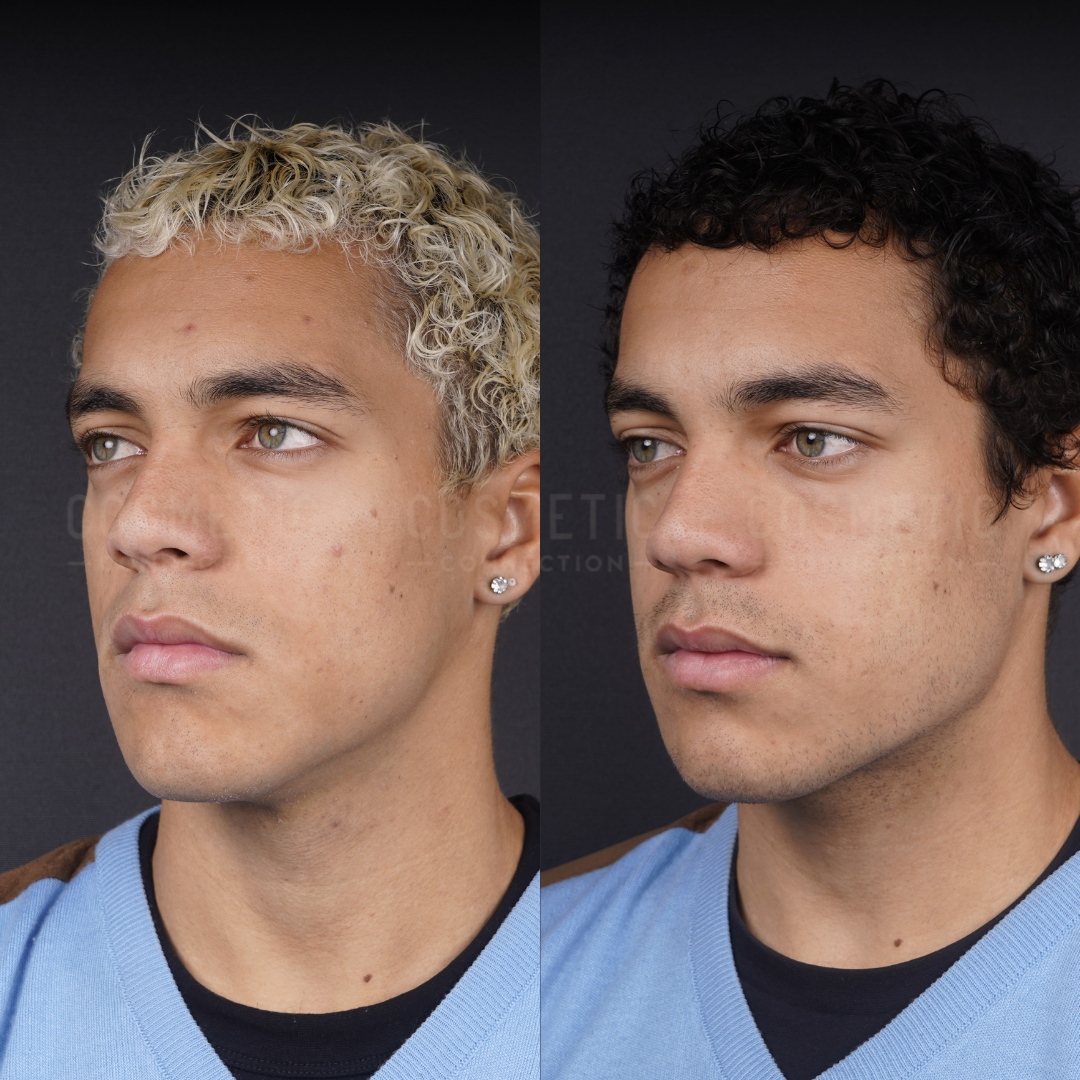 Side-by-side portraits of a young man with light blond curly hair and dark brown curly hair, wearing a blue sweater and earrings, against a black background.